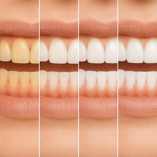 🦷✨ ¿Quieres una sonrisa más blanca, brillante y segura en pocos días?🦷✨