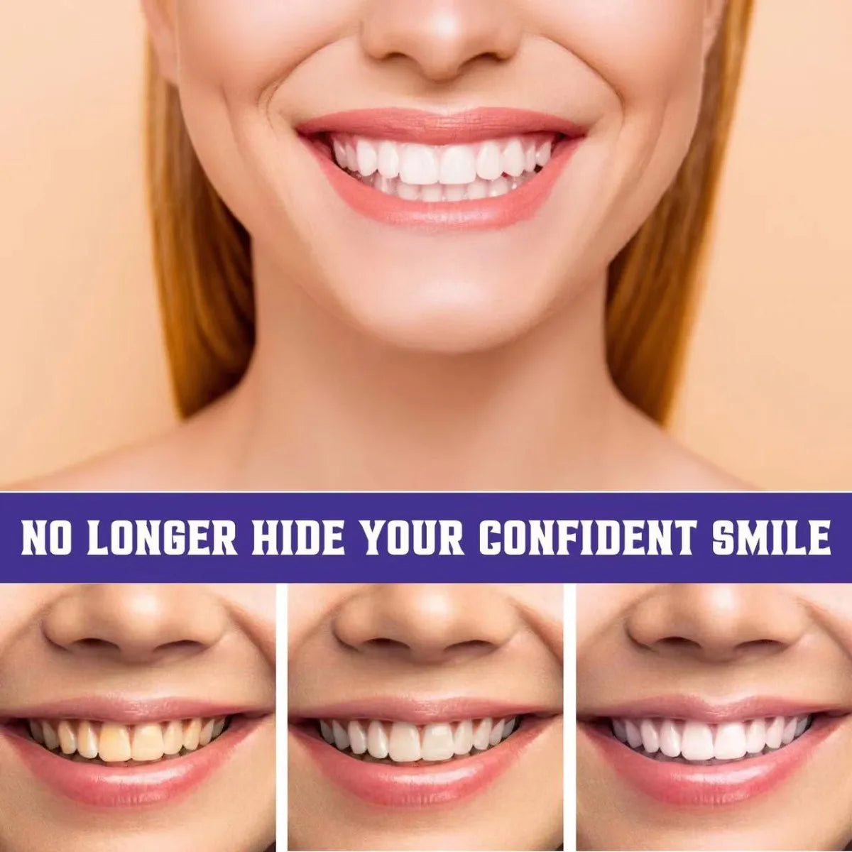 🦷✨ ¿Quieres una sonrisa más blanca, brillante y segura en pocos días?🦷✨